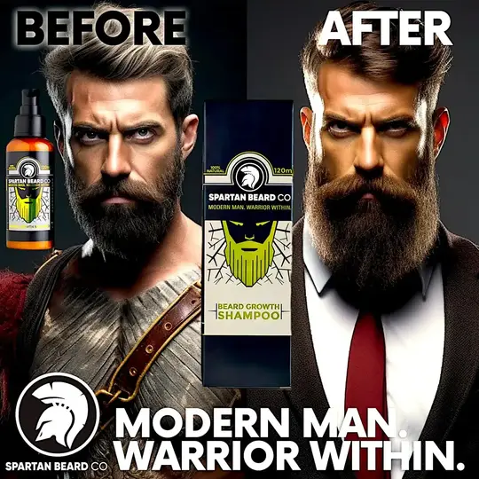 𝗦𝗣𝗔𝗥𝗧𝗔𝗡 𝗕𝗘𝗔𝗥𝗗™ شامبو (خصم 80% - الطلب الأول)